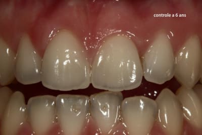 Image11 ciyrvu - Eugenol