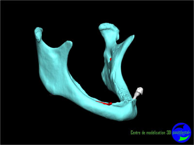 Image11 gf6g8m - Eugenol