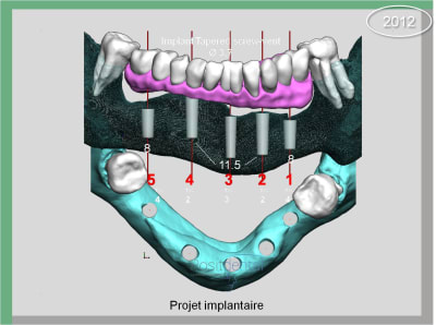 Image11 nbtv6e - Eugenol