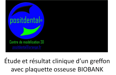 Image15 aiihdq - Eugenol