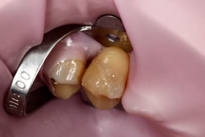 Image17 k2ssh1 - Eugenol