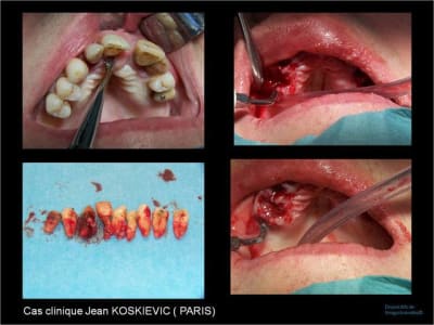 Image17 wd2hyj - Eugenol