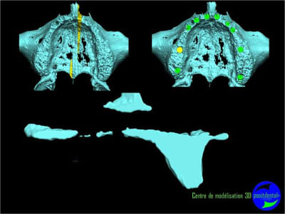 Image18 ydaonz - Eugenol