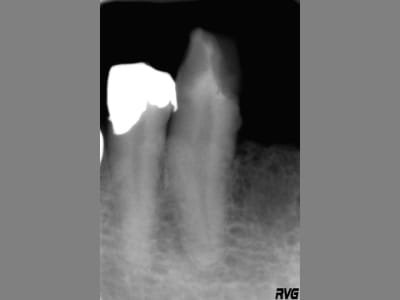 Image1 d4qxbo - Eugenol
