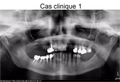 Image1 d8owwa - Eugenol