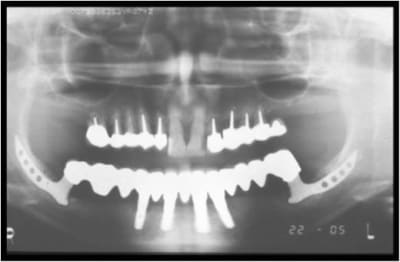 Image1 hcff4v - Eugenol