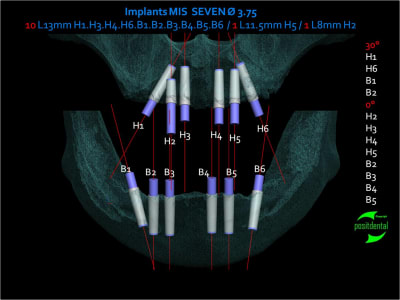 Image1 hemula - Eugenol