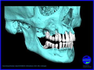 Image1 krocmo - Eugenol