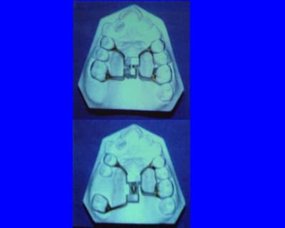 Image1 mh8e9r - Eugenol