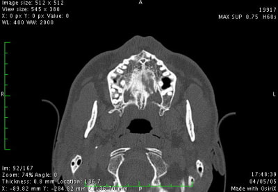 Image1 re07sv - Eugenol