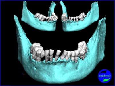 Image1 rlnsrb - Eugenol