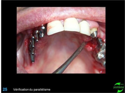 Image25 ut7ju5 - Eugenol