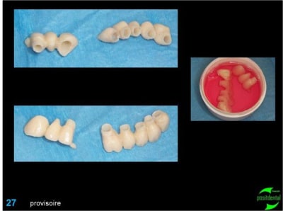 Image27 coloom - Eugenol