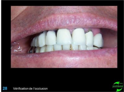 Image28 doyhbv - Eugenol