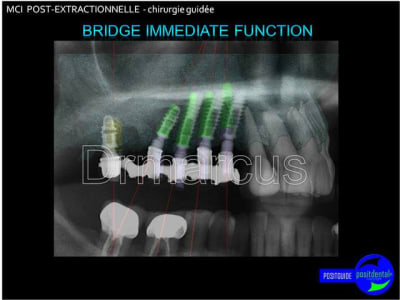 Image29 kxtb0v - Eugenol