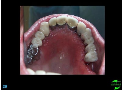 Image29 lfepfc - Eugenol