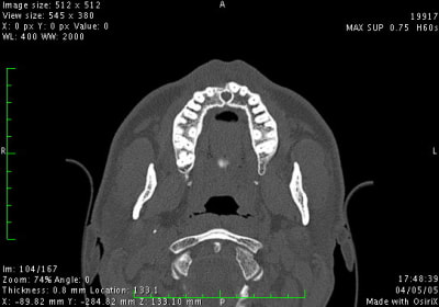 Image2 bipeqb - Eugenol
