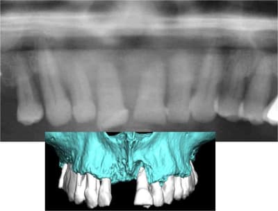 Image2 ntvvgo - Eugenol