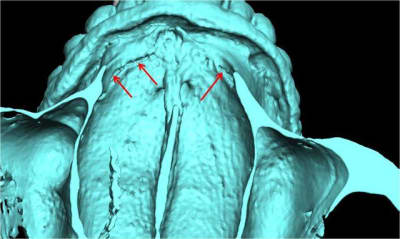 Image2 ryhehu - Eugenol