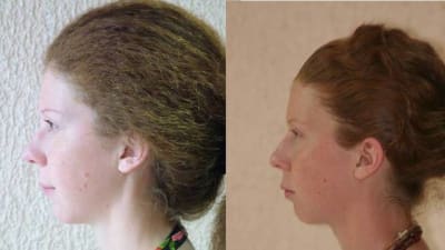 Image2 wely2r - Eugenol