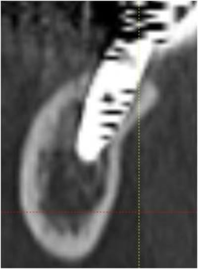 Image2r yr7csn - Eugenol