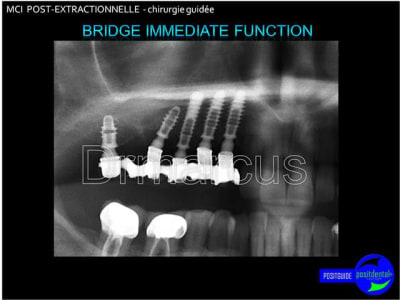 Image30 cwlmqc - Eugenol