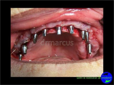 Image35 qjshmw - Eugenol