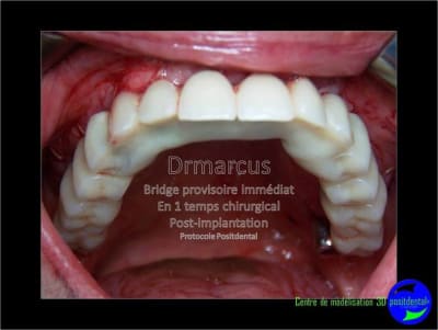 Image37 wniafk - Eugenol