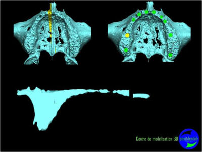 Image3 esnmun - Eugenol