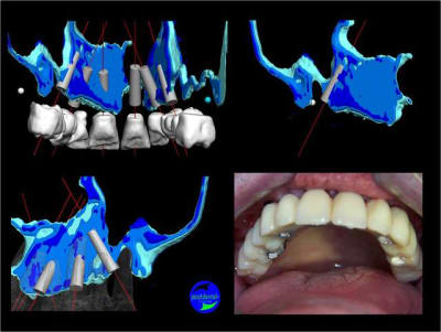 Image3 fjqnnz - Eugenol