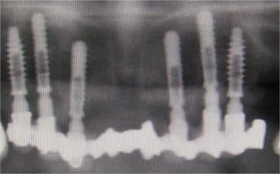 Image3 kzrsiz - Eugenol