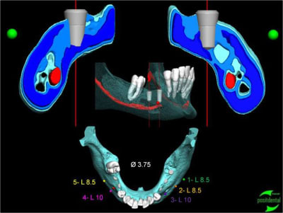 Image3 yyrocp - Eugenol