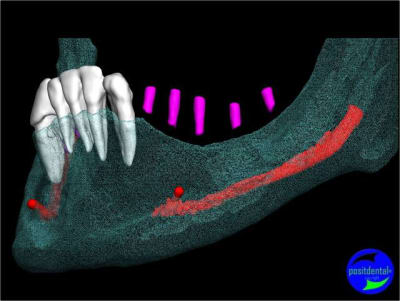 Image4 kl4qm3 - Eugenol