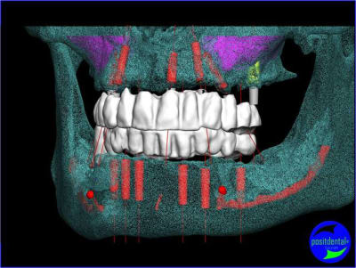 Image4 mo393f - Eugenol