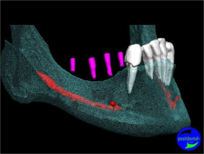 Image5 jlsn9q - Eugenol