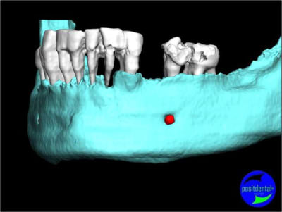 Image5 tjotsa - Eugenol