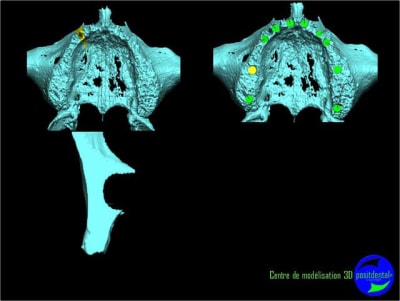 Image6 b2nfdv - Eugenol