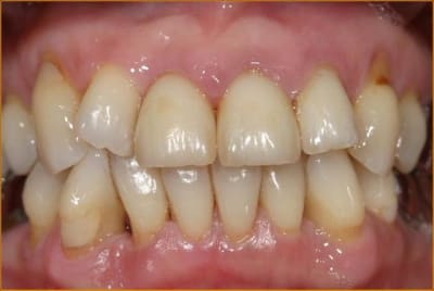 Image7 ofrmac - Eugenol