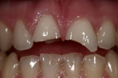 Image8 jwtcij - Eugenol