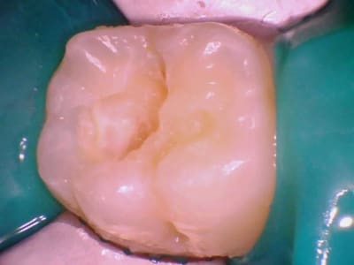 Image 003 hzzyun - Eugenol