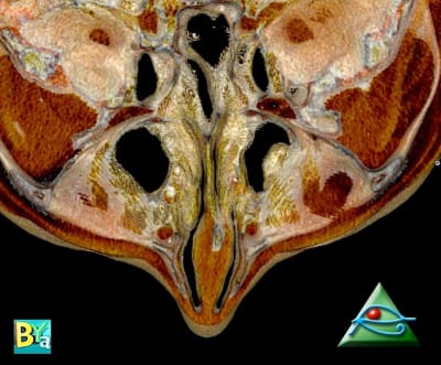 Image 3 rqkrl7 - Eugenol