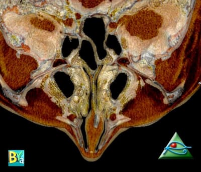 Image 4 m1m6yx - Eugenol