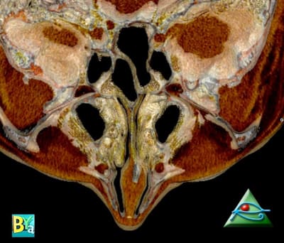 Image 5 nq8tkf - Eugenol