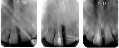 Imagezss1 o9dtye - Eugenol