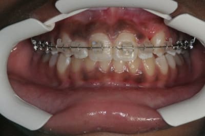 Img 3901 ueys3p - Eugenol