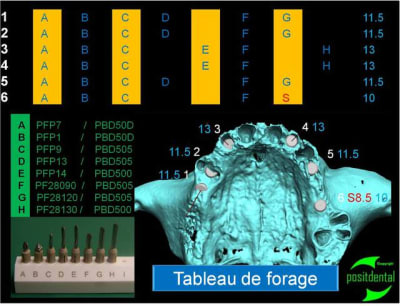 Implant angul  positdental 16 ekd4te - Eugenol