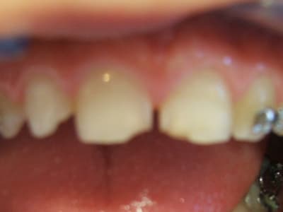 Julien avant qehjcf - Eugenol