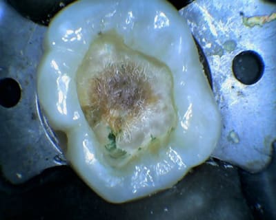Kk 2014 04 08 174504 gaqy07 - Eugenol