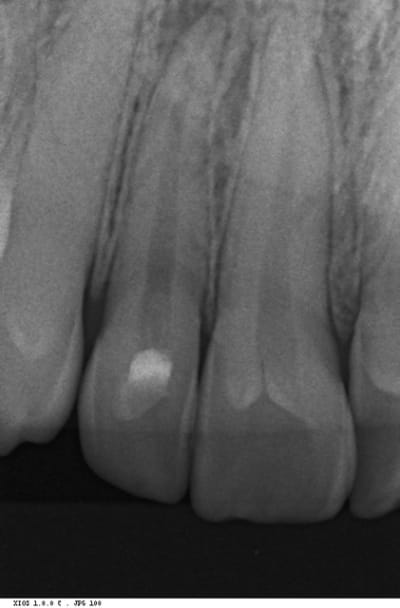 Lediouron s 20100802 13011 mutjri - Eugenol