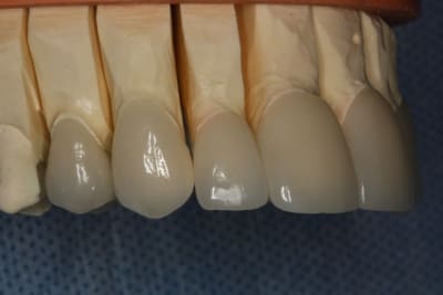 Labo 14 13 12 ylkwmk - Eugenol